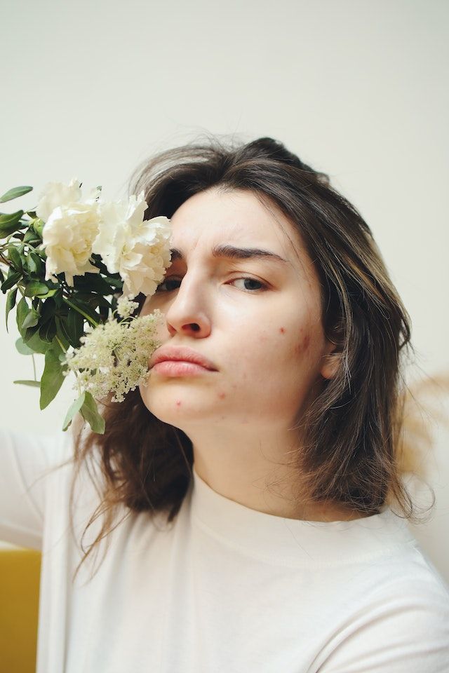 ragazza con pelle grassa