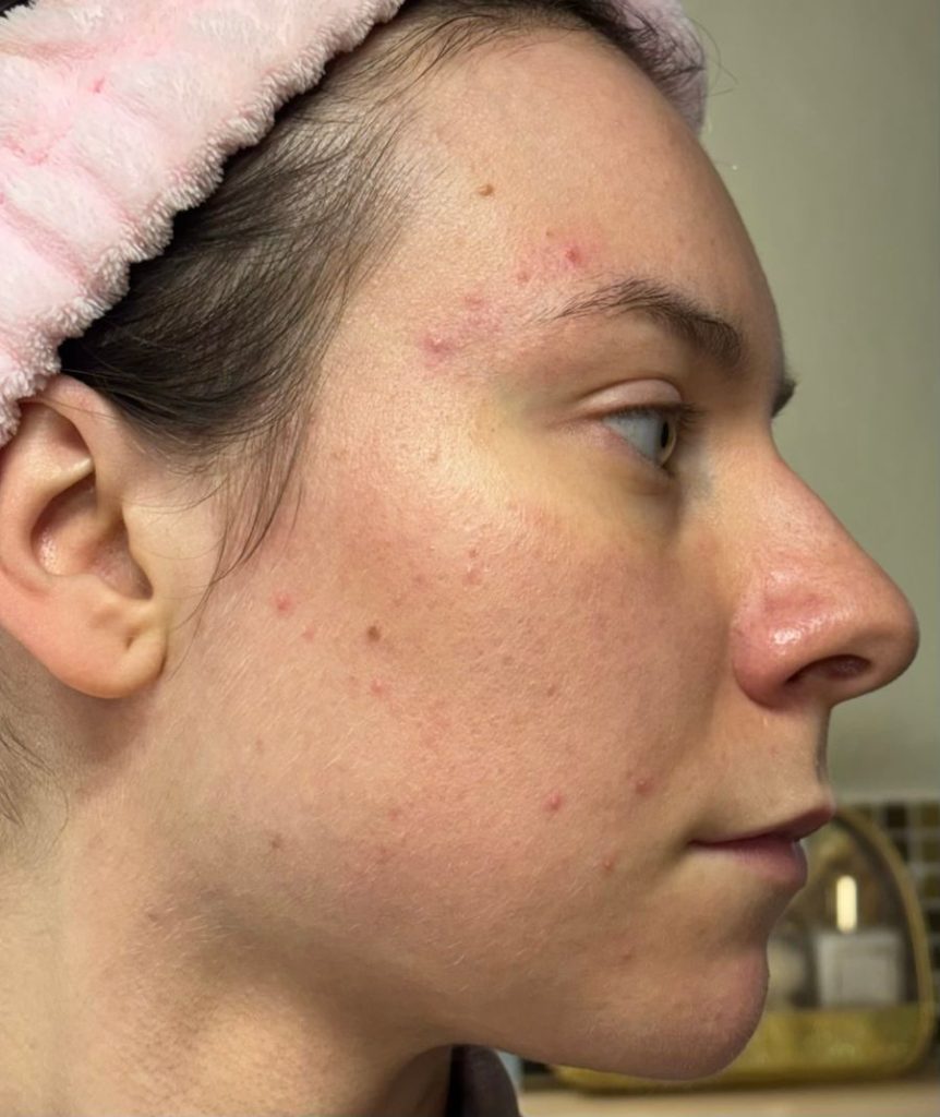 imparare ad ascoltare la propria pelle e i segnali che ci manda