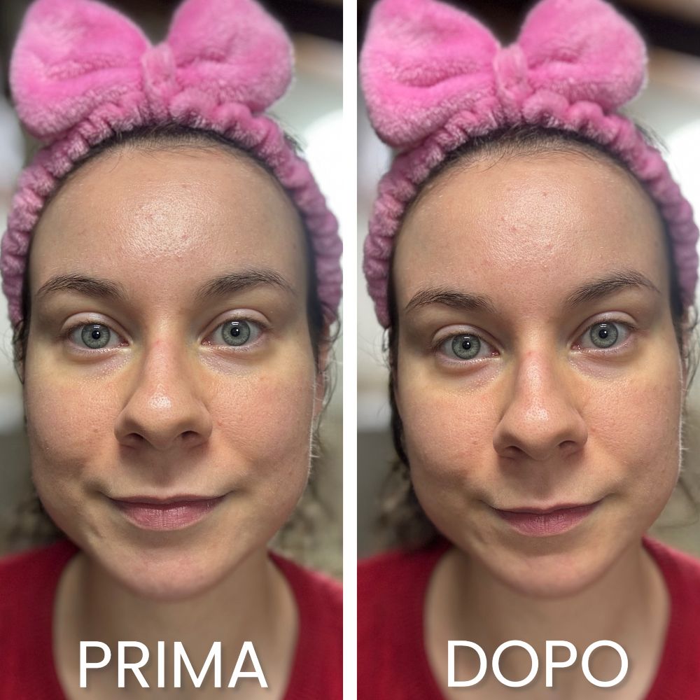 prima e dopo crema sorbetto idratante Garnier Hyaluron fresh & plump